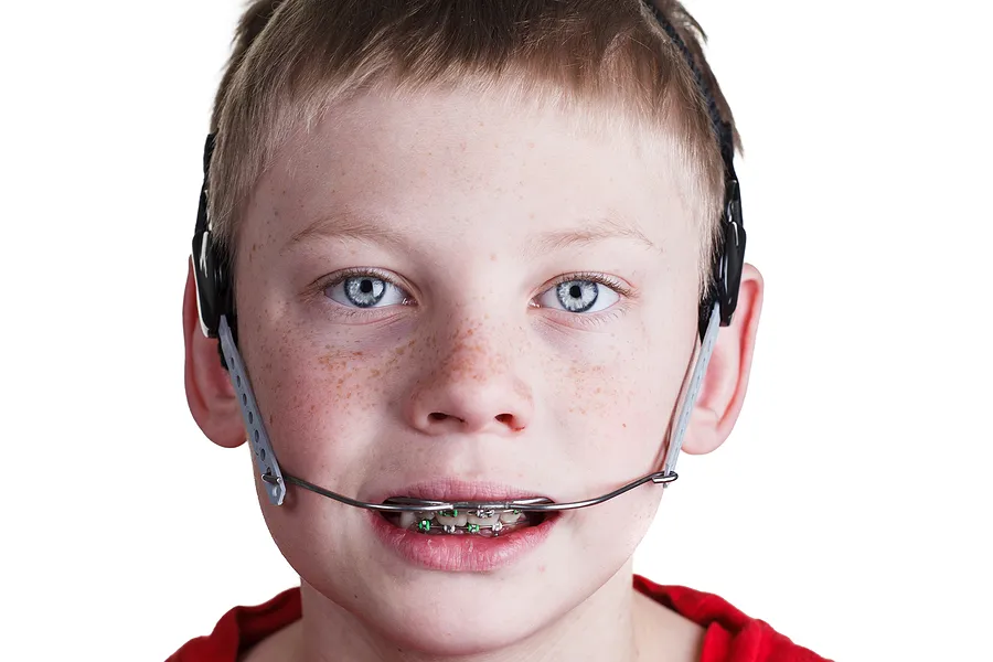 Orthodontic Headgear Can Help Your Child’s Developing Smile and Facial Profile