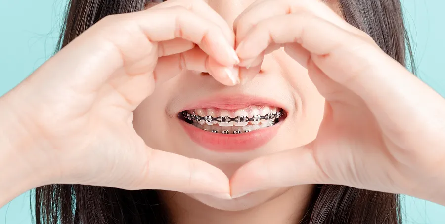 Why Are Braces so Important?