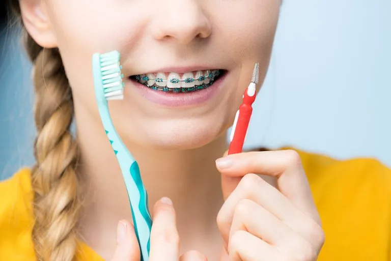 Essential Guide to Brushing and Flossing with Braces: Tips for a Healthy Smile