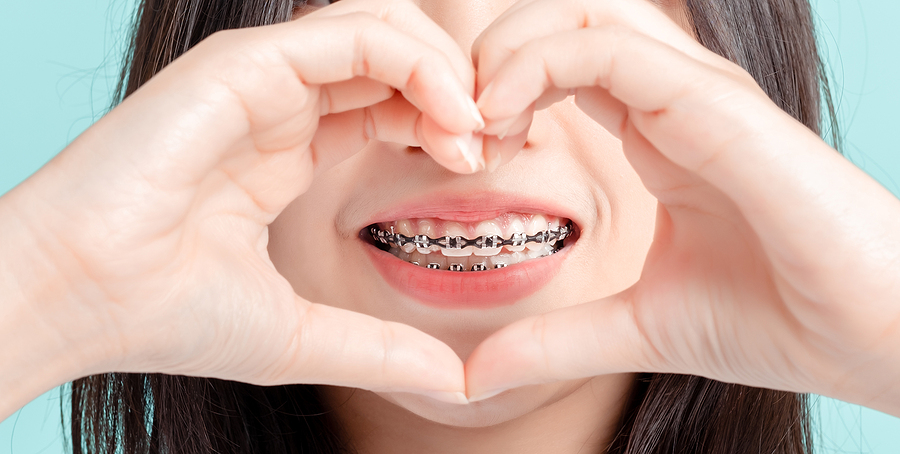 Wearing Braces Can Help Relieve Jaw Pain From a Misaligned Bite