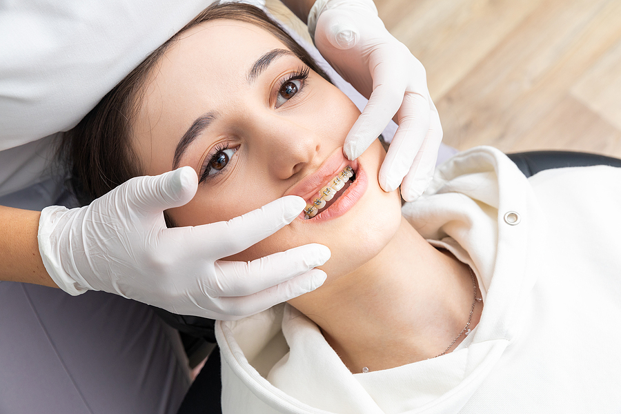 5 Reasons Why Traditional Braces Are the Best Option For You
