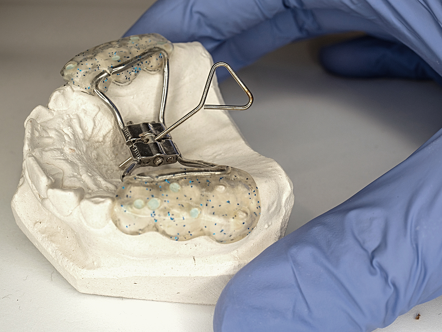 Understanding Palatal Expanders: A Key Solution for Orthodontic Health