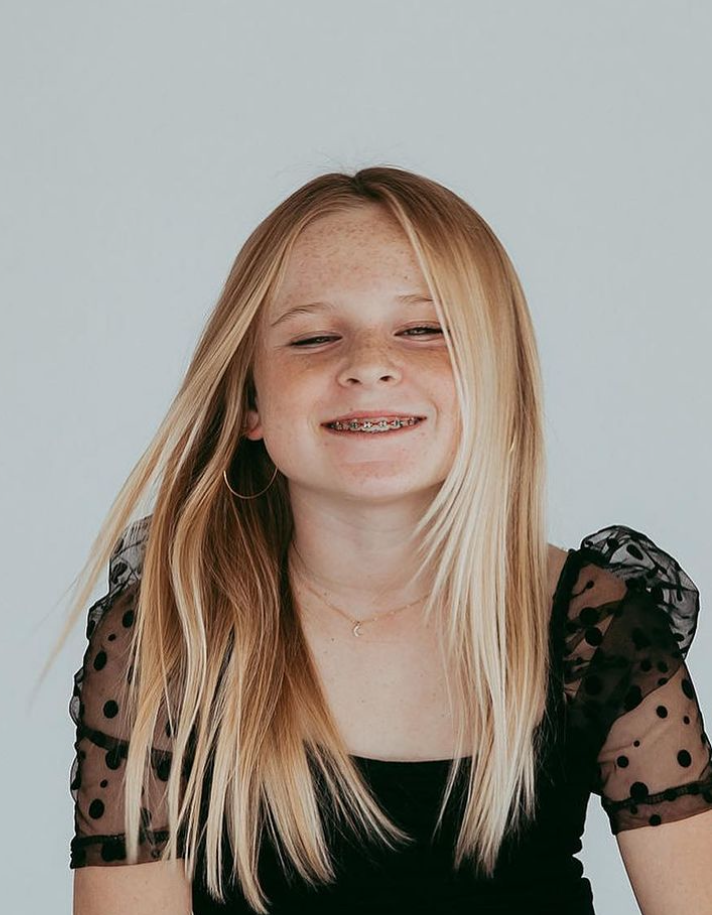 Orthodontics For Adults